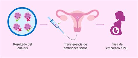 Ilustración del proceso de diagnóstico genético preimplantatorio