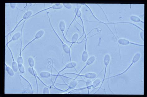 Microscopio con una muestra de FISH de espermatozoides