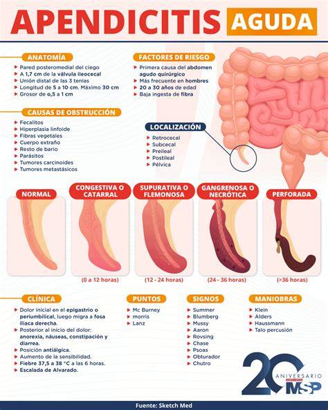Infografía comparativa: Niveles de dolor visceral (infarto, apendicitis, dismenorrea severa)
