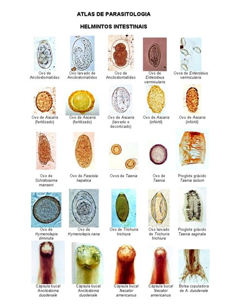 Microfotografía de huevos de parásitos intestinales caninos (áscaris, tricúridos, anquilostomas).