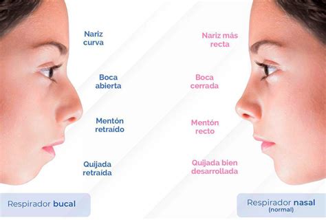 Infografía: Anatomía comparada de la respiración nasal frente a la respiración bucal en bebés.