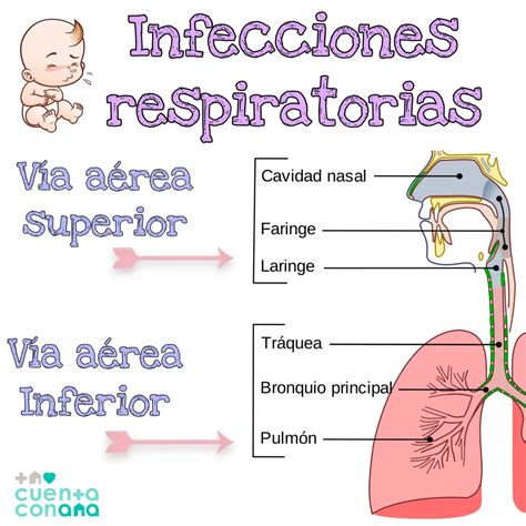 Esquema: Factores que provocan la obstrucción de las vías respiratorias superiores en el lactante.