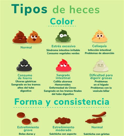 Esquema o infografía de tipos de heces de bebé por color y consistencia