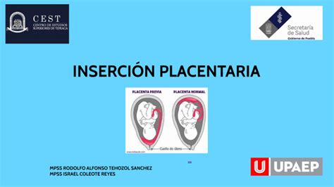 Ilustración esquemática del útero mostrando la zona de inserción placentaria y el sangrado en caso de atonía uterina.