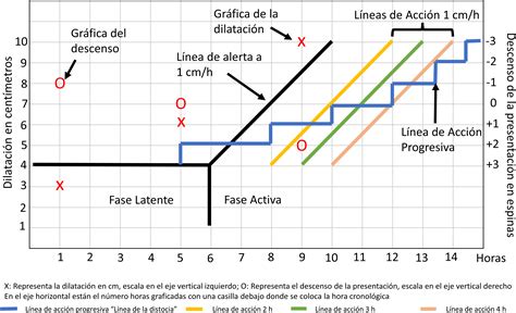 Gráfico de un partograma mostrando el progreso de la dilatación uterina y las contracciones.