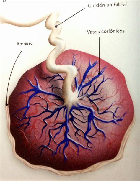 Diagrama de la placenta mostrando la superficie fetal con el cordón umbilical y los vasos coriónicos