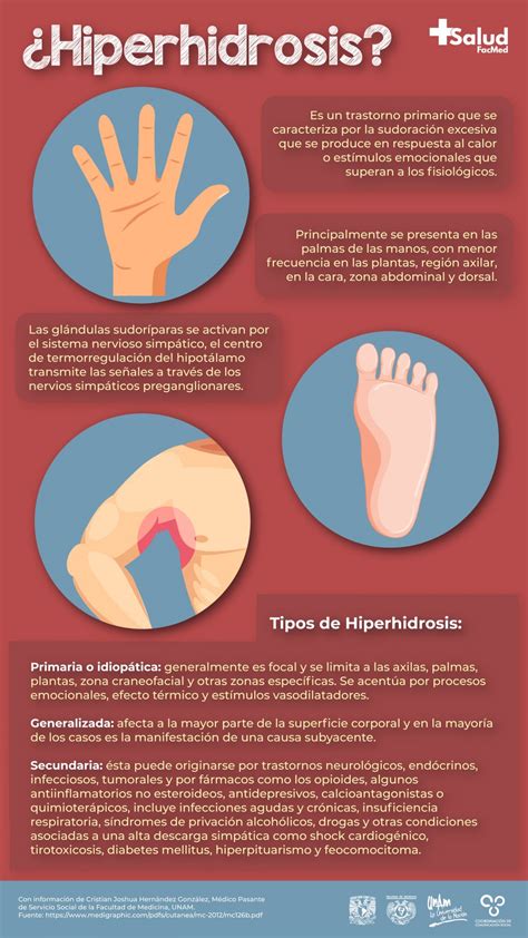 Infografía: Tipos de hiperhidrosis y zonas afectadas