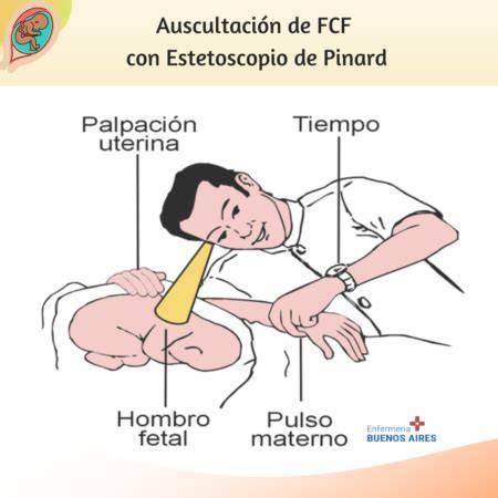 Profesional médico usando un estetoscopio de Pinard en una mujer embarazada durante el parto.