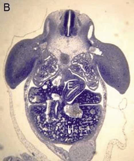 Corte transversal de un embrión humano de 10 semanas mostrando la cavidad torácica y la disposición de las hojas germinales.