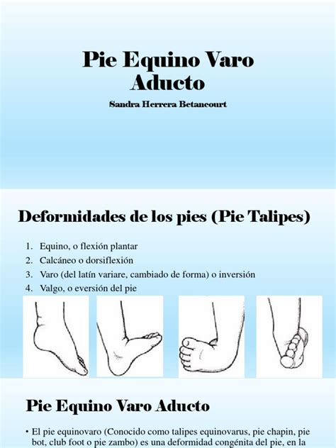 Aspecto clínico de un pie equino varo con equinismo, varismo y supinación del retropié y aducción del antepié