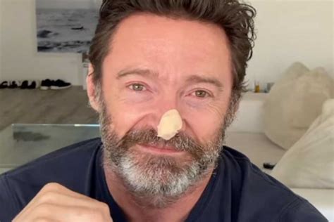 Foto de Hugh Jackman con la nariz vendada