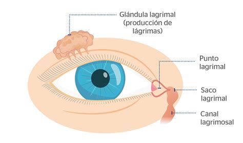 Esquema explicativo de la cirugía de lagrimal en niños