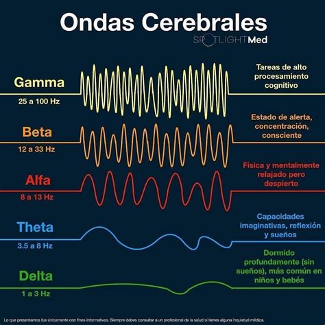 Esquema de las ondas cerebrales en un EEG con hipsarritmia