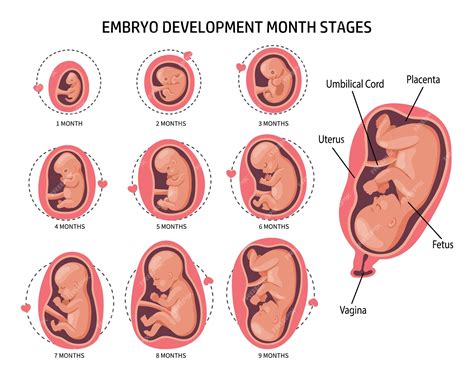 Infografía que detalla las diferentes etapas del apoyo de una doula durante el embarazo.