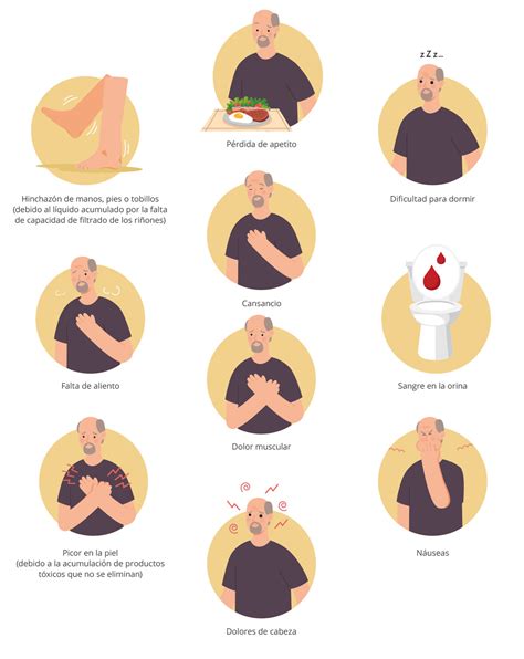 Infografía sobre los signos y síntomas de coágulos de sangre