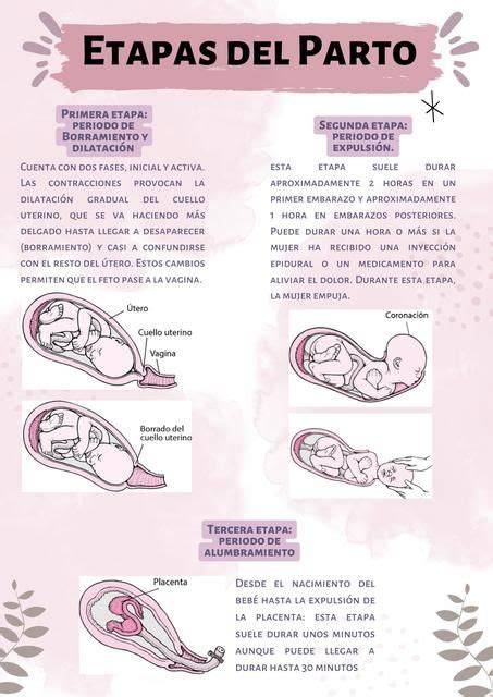 Esquema de las etapas del parto y los puntos de intervención para la inducción