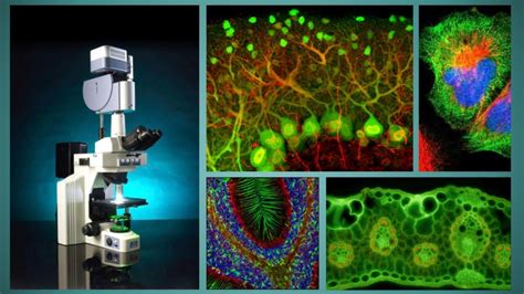 Microscopía de inmunofluorescencia de patrón ANA