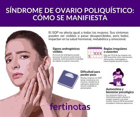 Infografía: Síntomas, diagnóstico y manejo del Síndrome de Ovario Poliquístico