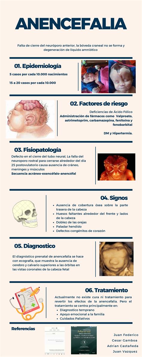 Esquema médico: Representación de anencefalia fetal y sus implicaciones