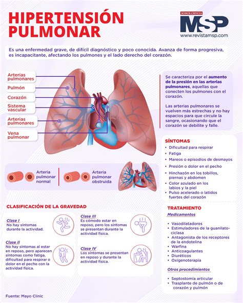 Infografía comparativa: ecografía pulmonar vs. radiografía en neonatos