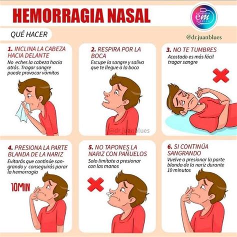 Infografía sobre los pasos para detener una hemorragia nasal en niños