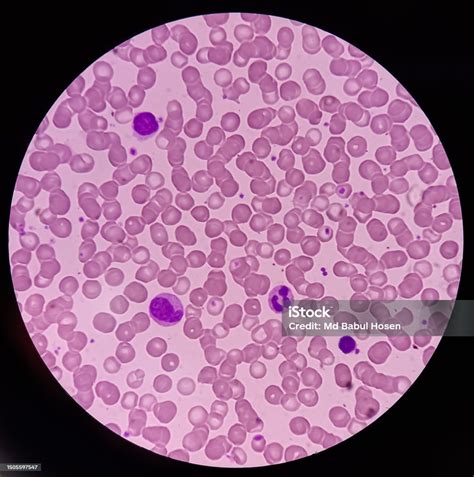 Microfotografía de leucocitos viables en calostro.