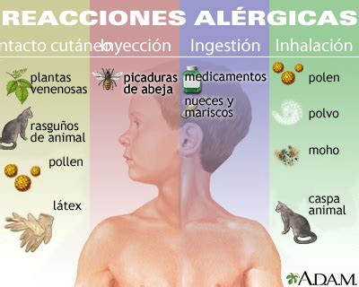 Esquema de las reacciones alérgicas más comunes en bebés