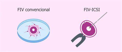Esquema de las diferencias entre FIV convencional e ICSI