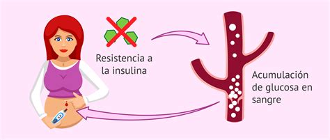 Esquema sobre la resistencia a la insulina durante el embarazo