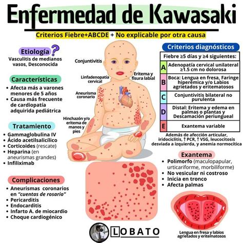 Infografía comparativa de síntomas entre Enfermedad de Kawasaki, Shock Tóxico y el nuevo síndrome multisistémico asociado a COVID-19.