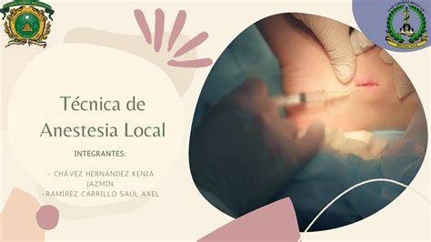 Esquema de las diferentes técnicas de anestesia para procedimientos ginecológicos