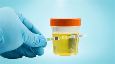 Comparación visual de la sensibilidad de los tests de orina y sangre para detectar hCG.