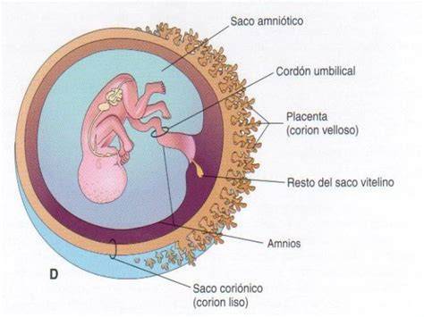 Foto ilustrativa del saco amniótico, el feto y el proceso de ruptura de membranas.