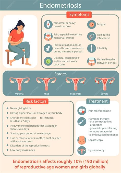 Infografía sobre la localización de la endometriosis extrapélvica, mostrando el tracto gastrointestinal como un sitio común