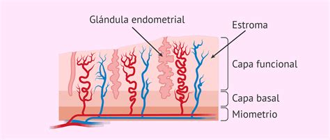 Diagrama de una glándula y estroma endometrial en la submucosa rectal
