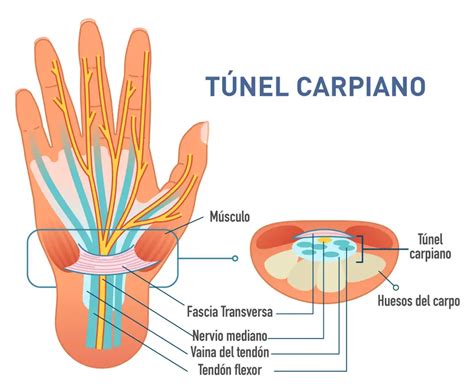 Esquema anatómico del túnel carpiano con el nervio mediano y los tendones
