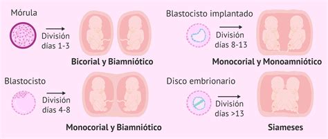 Esquema de tipos de embarazos gemelares: bicorial-biamniótico, monocorial-biamniótico y monocorial-monoamniótico.