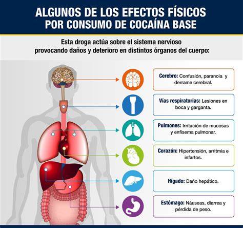 Infografía: Efectos de la diástasis en el cuerpo