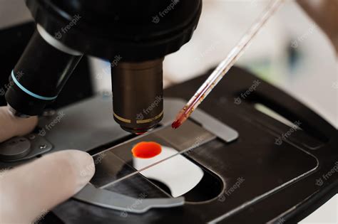 Equipo de laboratorio analizando muestras de sangre para Beta hCG