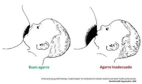 Ilustración de un agarre correcto e incorrecto del bebé al pecho, mostrando cómo el mal agarre puede causar grietas