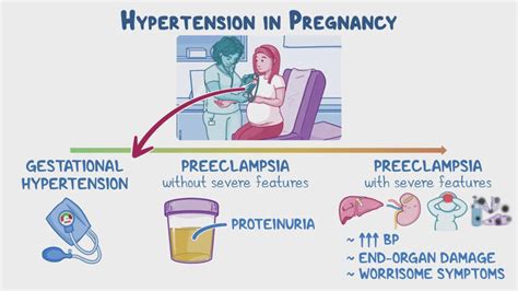 esquema comparativo entre hipertensión gestacional y preeclampsia