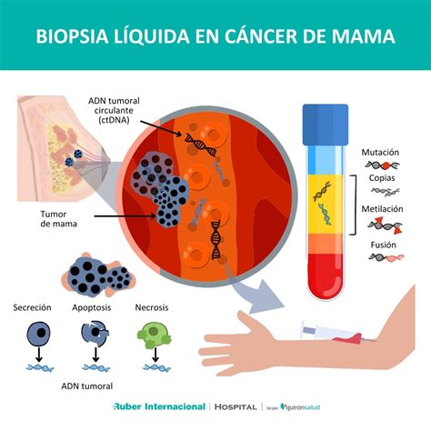 Esquema sobre el concepto de biopsia líquida para la detección de cáncer