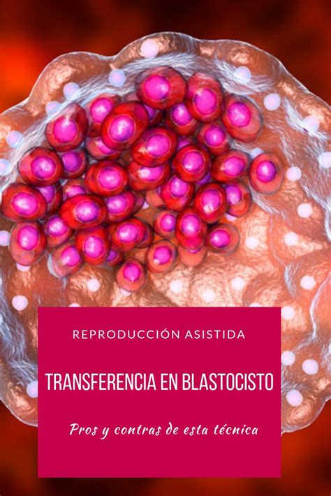 Infografía: Ventajas de la transferencia de blastocistos en FIV