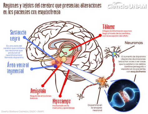 Esquema de un cerebro con resaltado de áreas afectadas por la esquizofrenia