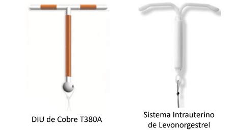 Diagrama del DIU de cobre y del DIU hormonal, destacando sus mecanismos de acción y compatibilidad con la lactancia.