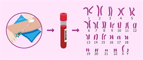 Esquema de la extracción de sangre para análisis de cariotipo