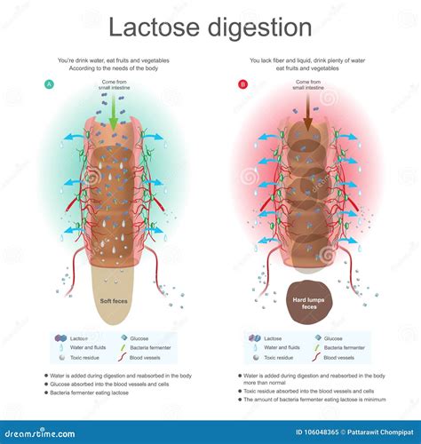 Ilustración que compara la digestión de la lactosa en un intestino sano y en uno con intolerancia.