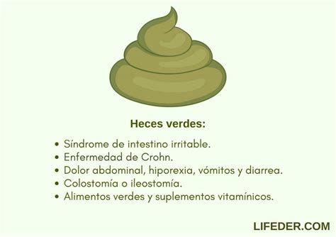 Infografía sobre causas de heces verdes en bebés