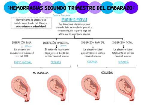Esquema de las causas de los pinchazos abdominales en el primer trimestre de embarazo