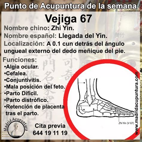 Diagrama que muestra la ubicación del punto de acupuntura Vejiga-67 en el dedo meñique del pie para moxibustión